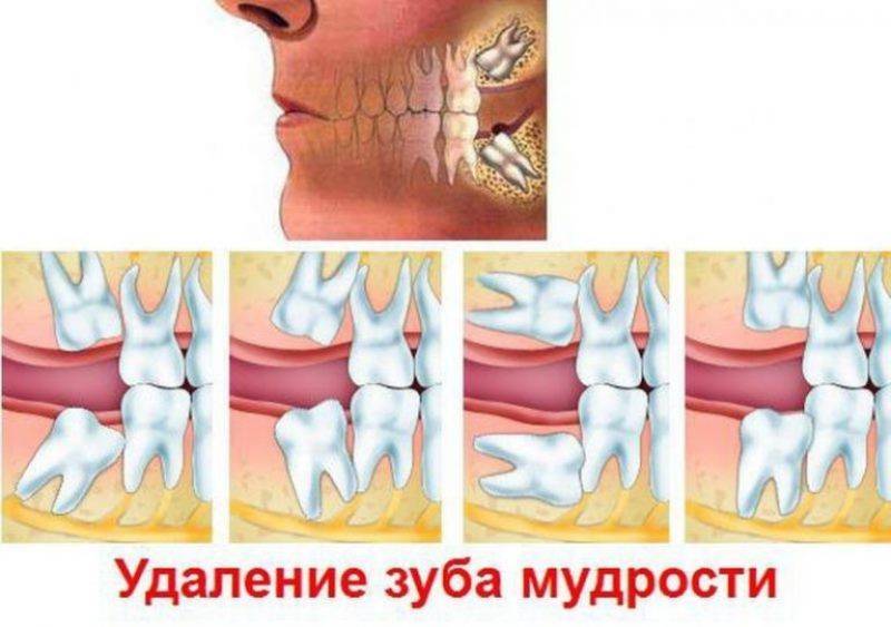 Стоит ли удалять нижние листья капусты и как увеличить размер головки