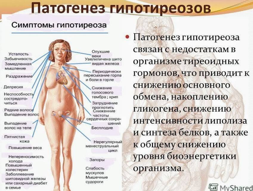 Психические заболевания - характеристика, симптомы, виды, лечение | университетская клиника